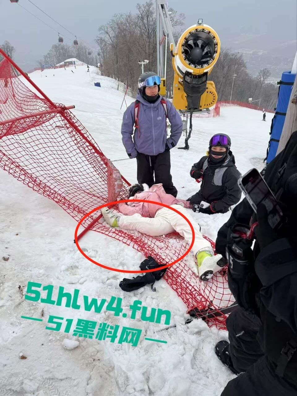 北大湖滑雪场新手滑雪妹,误入中高级滑道滑雪,不慎摔飞被撞到变形断腿场面超吓人。 第1张 北大湖滑雪场新手滑雪妹,误入中高级滑道滑雪,不慎摔飞被撞到变形断腿场面超吓人。 第1张