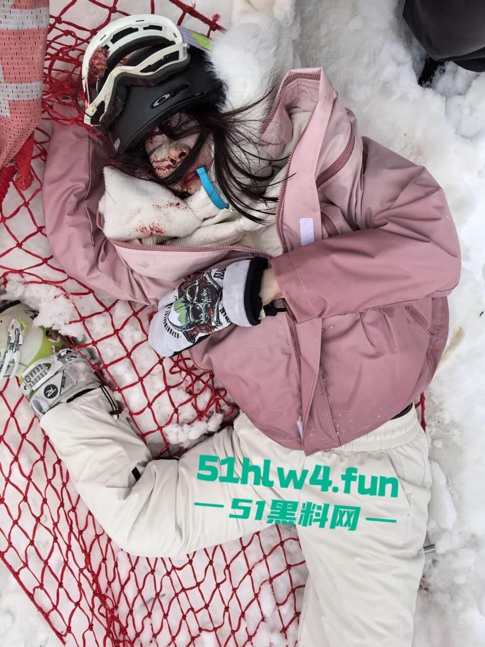 北大湖滑雪场新手滑雪妹,误入中高级滑道滑雪,不慎摔飞被撞到变形断腿场面超吓人。 第9张 北大湖滑雪场新手滑雪妹,误入中高级滑道滑雪,不慎摔飞被撞到变形断腿场面超吓人。 第9张