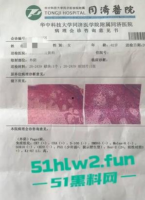 真实母子乱伦大瓜!儿子发现母亲的聊天记录后兽性大发,用手机拍视频录下与母亲的性爱视频曝光。 第1张 真实母子乱伦大瓜!儿子发现母亲的聊天记录后兽性大发,用手机拍视频录下与母亲的性爱视频曝光。 第1张