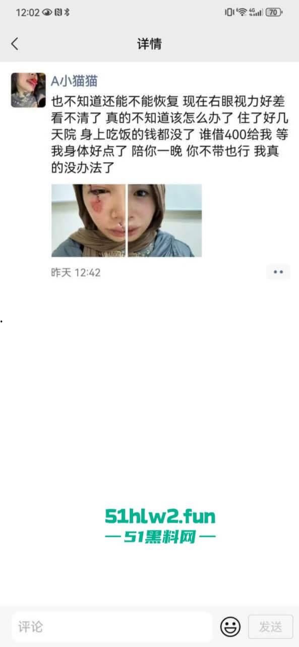 卖惨惯犯纹身妹,骑电瓶车出车祸惨遭破相朋友圈无奈卖身求钱就医,骚货的卖身已成习惯。 第5张 卖惨惯犯纹身妹,骑电瓶车出车祸惨遭破相朋友圈无奈卖身求钱就医,骚货的卖身已成习惯。 第5张