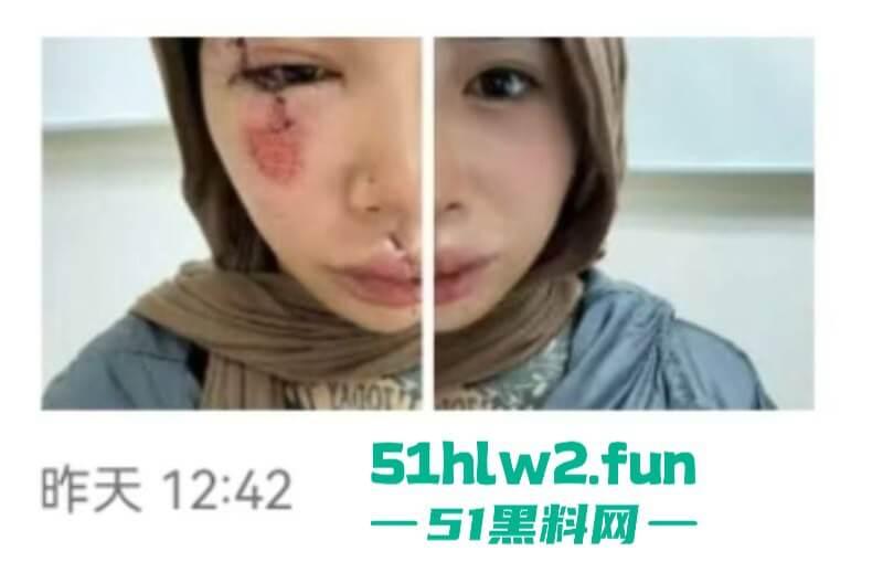 卖惨惯犯纹身妹,骑电瓶车出车祸惨遭破相朋友圈无奈卖身求钱就医,骚货的卖身已成习惯。 第6张 卖惨惯犯纹身妹,骑电瓶车出车祸惨遭破相朋友圈无奈卖身求钱就医,骚货的卖身已成习惯。 第6张