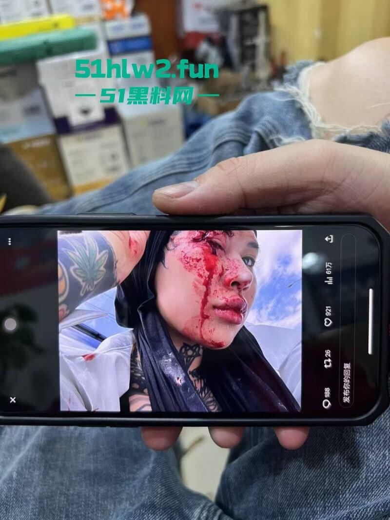 卖惨惯犯纹身妹,骑电瓶车出车祸惨遭破相朋友圈无奈卖身求钱就医,骚货的卖身已成习惯。 第7张 卖惨惯犯纹身妹,骑电瓶车出车祸惨遭破相朋友圈无奈卖身求钱就医,骚货的卖身已成习惯。 第7张