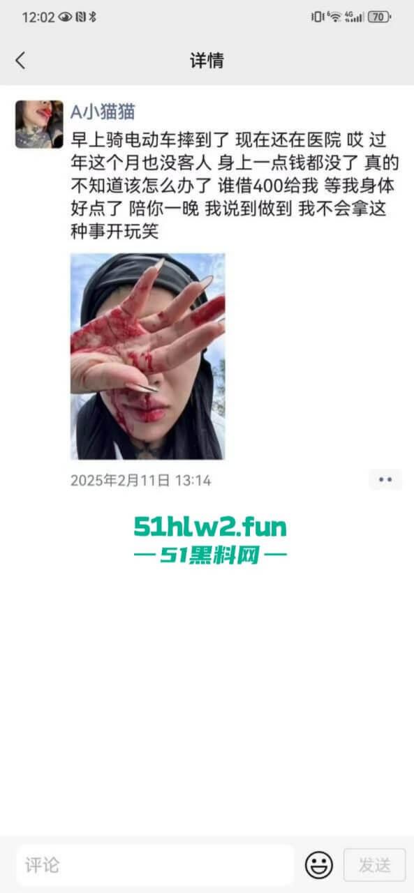 卖惨惯犯纹身妹,骑电瓶车出车祸惨遭破相朋友圈无奈卖身求钱就医,骚货的卖身已成习惯。 第8张 卖惨惯犯纹身妹,骑电瓶车出车祸惨遭破相朋友圈无奈卖身求钱就医,骚货的卖身已成习惯。 第8张