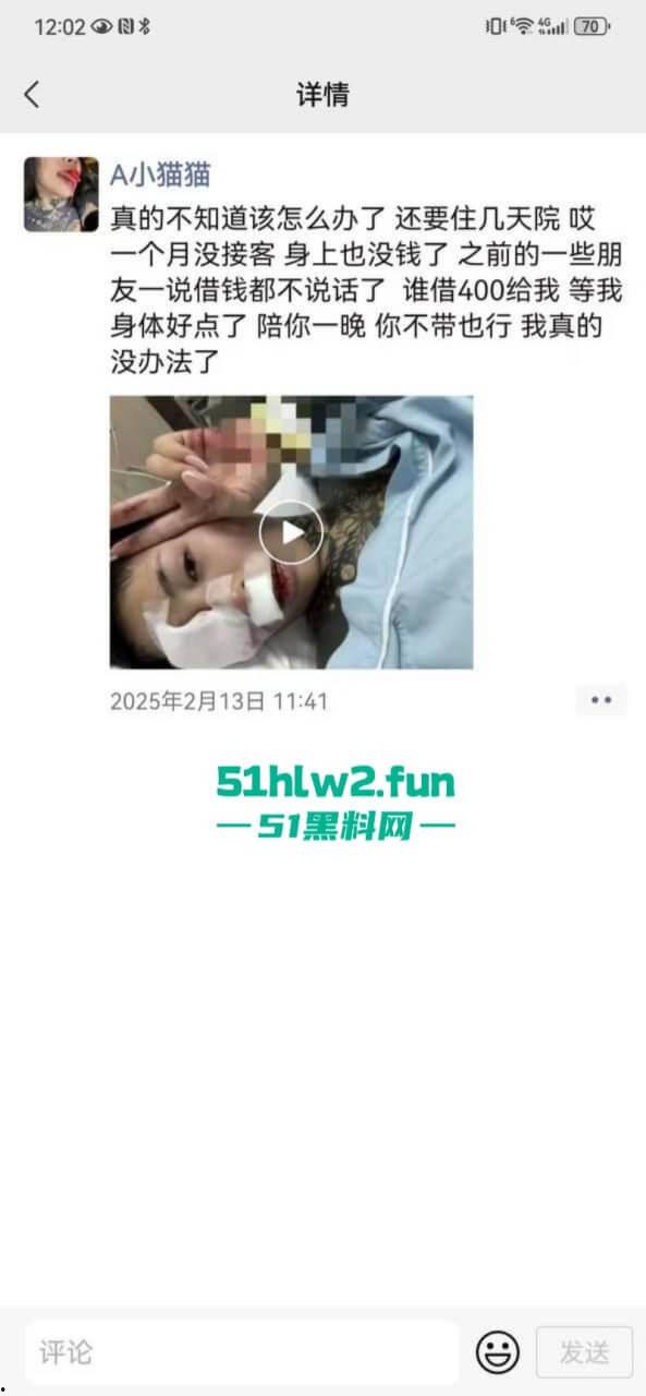 卖惨惯犯纹身妹,骑电瓶车出车祸惨遭破相朋友圈无奈卖身求钱就医,骚货的卖身已成习惯。 第9张 卖惨惯犯纹身妹,骑电瓶车出车祸惨遭破相朋友圈无奈卖身求钱就医,骚货的卖身已成习惯。 第9张