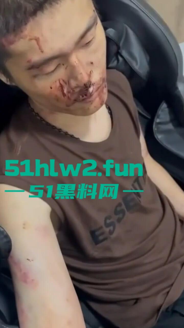 园区猪仔真实近况，绑架后只有受虐的份，电击殴打口吐鲜血境外没有高薪工作，只有无尽的折磨。  第5张