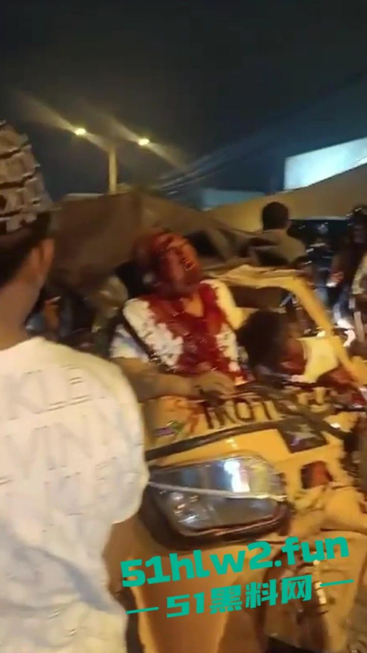 老头乐车祸现场因超速追尾，老头被当场甩出满脸是血，这回老头乐坏了老头也不乐了。  第3张