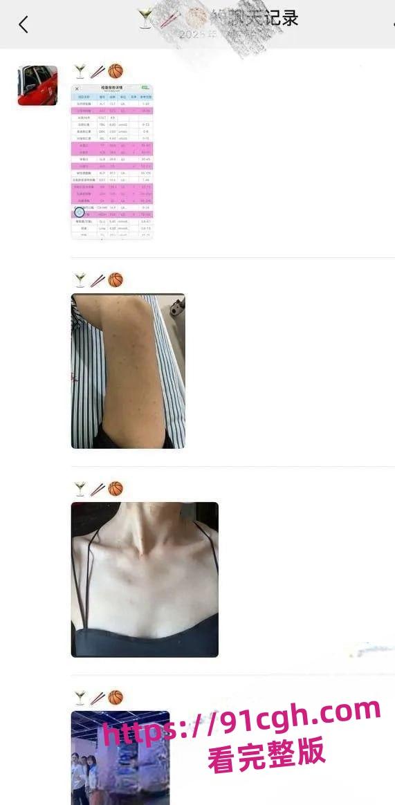 抖音女网红 轮滑冰姑娘 被曝竟是生化母体 携带艾滋卖淫感染超千人 第8张 抖音女网红 轮滑冰姑娘 被曝竟是生化母体 携带艾滋卖淫感染超千人 第8张