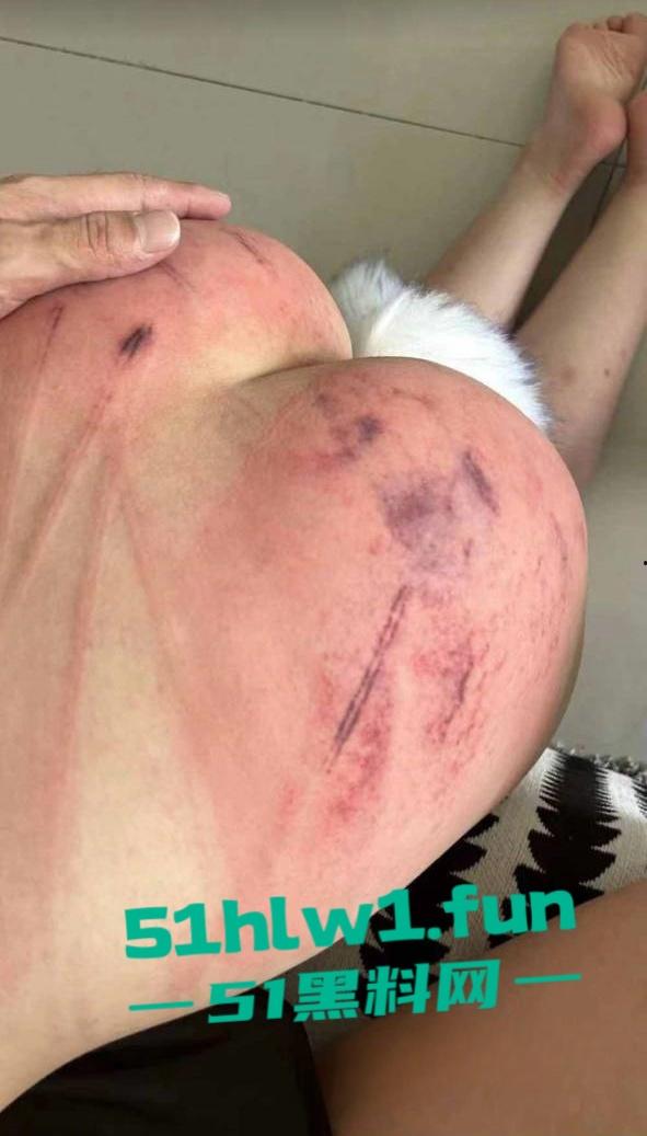 山东滨州博兴三中学生妹【于翰然】SM现场视频为了追求极致体验屁股都被大叔给打烂流血了 第1张 山东滨州博兴三中学生妹【于翰然】SM现场视频为了追求极致体验屁股都被大叔给打烂流血了 第1张