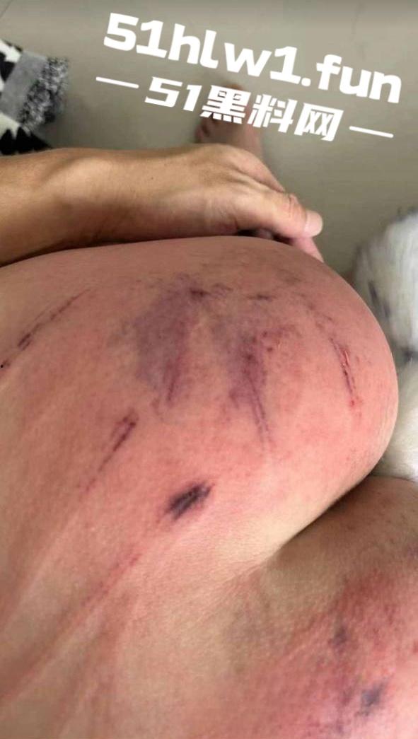 山东滨州博兴三中学生妹【于翰然】SM现场视频为了追求极致体验屁股都被大叔给打烂流血了 第5张 山东滨州博兴三中学生妹【于翰然】SM现场视频为了追求极致体验屁股都被大叔给打烂流血了 第5张