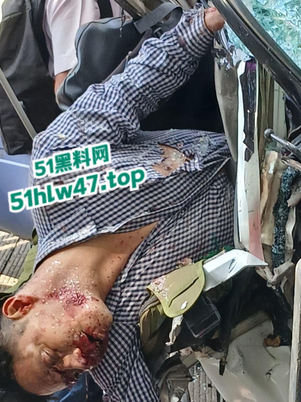 【血腥恐怖】印尼发生惨烈车祸,超速行驶失控后撞上前方货车,导致多人死亡司机直接面目全非。 第1张 【血腥恐怖】印尼发生惨烈车祸,超速行驶失控后撞上前方货车,导致多人死亡司机直接面目全非。 第1张